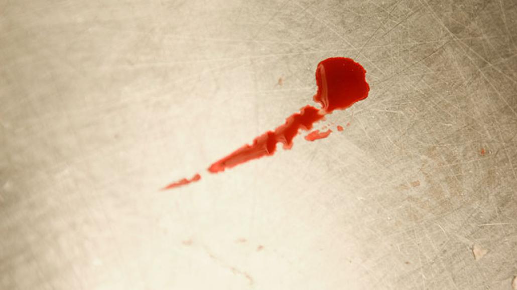 Blutspur führte zu Täter
