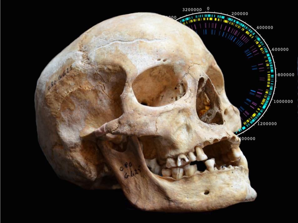 Lepra – neue Einblicke mit Hilfe der „alte DNA“-Forschung